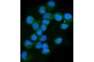 IF analysis of Neurofibromin/NF1 using anti-Neurofibromin/NF1 antibody (ABIN7600197). (Neurofibromin 1 Antikörper  (AA 160-270))