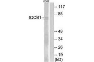 Western blot analysis of extracts from K562 cells, using IQCB1 Antibody.
