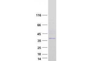 Validation with Western Blot (SPG21 Protein (Transcript Variant 2) (Myc-DYKDDDDK Tag))