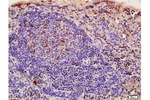Immunohistochemistry (IHC) image for anti-Cysteine Rich Transmembrane BMP Regulator 1 (Chordin-Like) (CRIM1) (AA 901-1028) antibody (ABIN676853)