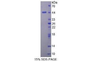 SDS-PAGE analysis of Human DHPS Protein. (DHPS Protein)