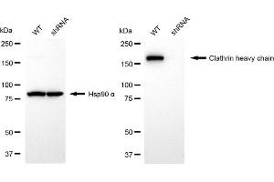 Western blotting analysis using clathrin heavy chain antibody (ABIN7798091).