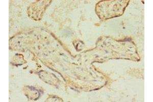 Immunohistochemistry of paraffin-embedded human placenta tissue using ABIN7158507 at dilution of 1:100 (ACSL4 Antikörper  (AA 457-670))