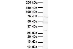 WB Suggested Anti-LBX1 antibody Titration: 1 ug/mL Sample Type: Human heart (Lbx1 Antikörper  (Middle Region))