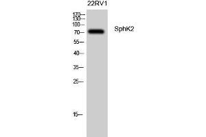 Western Blot (WB) analysis of 22RV1 cells using SphK2 Polyclonal Antibody. (SPHK2 Antikörper  (Tyr754))