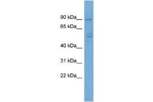 WB Suggested Anti-CDH4  Antibody Titration: 0. (Cadherin 4 Antikörper  (Middle Region))