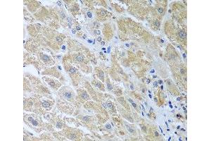 Immunohistochemistry of paraffin-embedded Human liver using WDR48 Polyclonal Antibody at dilution of 1:100 (40x lens). (WDR48 Antikörper)