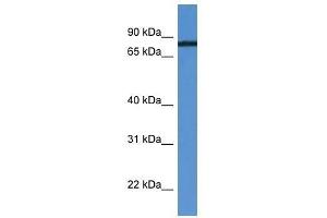 HHIPL1 antibody used at 0. (HHIPL1 Antikörper  (C-Term))