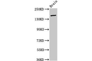 Western Blot Positive WB detected in: Rat brain tissue All lanes: ADGRB2 antibody at 3. (BAI2 Antikörper  (AA 1371-1545))