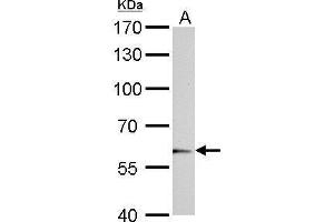 Western Blotting (WB) image for anti-UDP Glucuronosyltransferase 1 Family, Polypeptide A6 (UGT1A6) (Center) antibody (ABIN2856941)