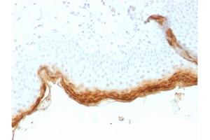 Formalin-fixed, paraffin-embedded human Skin stained with Filaggrin Mouse Recombinant Monoclonal Antibody (rFLG/1561). (Rekombinanter Filaggrin Antikörper  (AA 198-288))