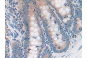 Detection of SERPINA10 in Rat Intestine Tissue using Polyclonal Antibody to Serpin A10 (SERPINA10)