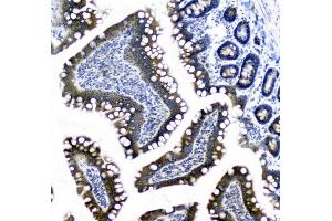 IHC analysis of CIC using anti-CIC antibody (ABIN6719536).