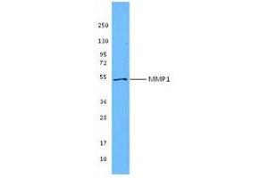 Image no. 1 for anti-Matrix Metallopeptidase 1 (Interstitial Collagenase) (MMP1) antibody (ABIN205496) (MMP1 Antikörper)