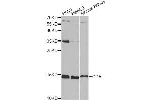 Western blot analysis of extracts of various cell lines, using CDA antibody (ABIN6291347) at 1:1000 dilution. (CDA Antikörper)