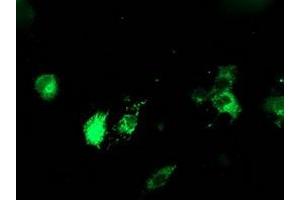 Image no. 4 for anti-Protein Disulfide Isomerase Family A, Member 4 (PDIA4) antibody (ABIN1500106)