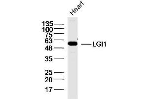 Mouse heart lysates probed with GI1 Polyclonal Antibody, unconjugated  at 1:300 overnight at 4°C followed by a conjugated secondary antibody for 60 minutes at 37°C. (LGI1 Antikörper  (AA 451-557))