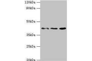 Western blot All lanes: MICA antibody at 8 μg/mL Lane 1: MCF-7 whole cell lysate Lane 2: A431 whole cell lysate Lane 3: Mouse Stomach tissue Secondary Goat polyclonal to rabbit IgG at 1/10000 dilution Predicted band size: 43, 32 kDa Observed band size: 43 kDa (MICA Antikörper  (AA 24-307))