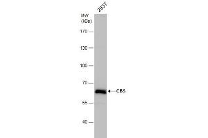 WB Image CBS antibody detects CBS protein by western blot analysis. (CBS Antikörper)