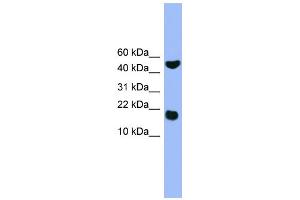 WB Suggested Anti-RWDD1 Antibody Titration: 0. (RWDD1 Antikörper  (Middle Region))