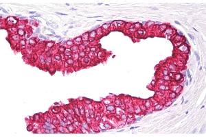 Immunohistochemistry staining of human prostate (paraffin section) using anti-cytokeratin 5/8 (clone C-50). (Keratin 5/8 Antikörper)