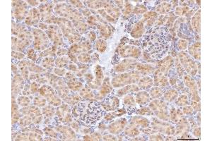 IHC analysis of BHMT using anti-BHMT antibody (ABIN7599940). (BHMT Antikörper  (AA 13-386))