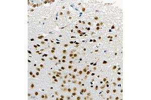 Immunohistochemistry of paraffin embedded mouse brain using UBE3A (ABIN7076104) at dilution of 1:1000 (400x lens) (ube3a Antikörper)