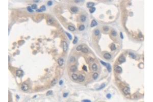 Detection of NSF in Human Kidney Tissue using Polyclonal Antibody to N-Ethylmaleimide Sensitive Factor (NSF) (NSF Antikörper  (AA 590-744))