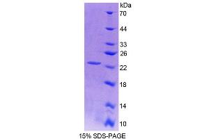SDS-PAGE analysis of Rat vHL Protein. (VHL Protein)
