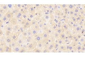 Detection of GSTp in Mouse Liver Tissue using Polyclonal Antibody to Glutathione S Transferase Pi (GSTp) (GSTP1 Antikörper  (AA 1-210))