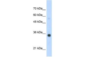 WB Suggested Anti-HOXB4 Antibody Titration:  1.