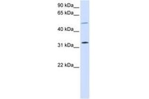 Image no. 1 for anti-Short Stature Homeobox 2 (SHOX2) (AA 108-157) antibody (ABIN6744236)