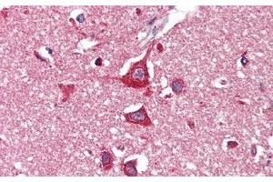 Detection of HEXb in Human Cerebrum Tissue using Polyclonal Antibody to Hexosaminidase B Beta (HEXb)