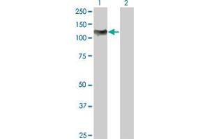 Western Blotting (WB) image for anti-Nuclear Factor of kappa Light Polypeptide Gene Enhancer in B-Cells 1 (NFKB1) (AA 860-969) antibody (ABIN598837) (NFKB1 Antikörper  (AA 860-969))
