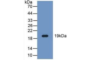 Detection of Recombinant FADS2, Human using Polyclonal Antibody to Fatty Acid Desaturase 2 (FADS2) (FADS2 Antikörper  (AA 1-130))