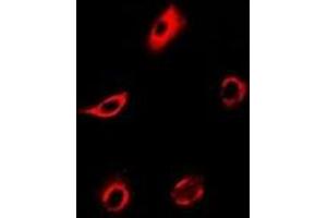 Immunofluorescent analysis of PPX staining in MCF7 cells. (PPP4C Antikörper)