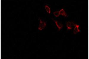 ABIN6267277 staining 293 by IF/ICC. (Estrogen Receptor alpha Antikörper  (pSer106))