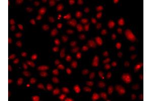 Immunofluorescence analysis of A549 cell using FBXW11 antibody. (FBXW11 Antikörper)