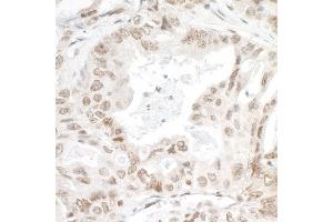 Immunohistochemistry (IHC) image for anti-PC4 and SFRS1 Interacting Protein 1 (PSIP1) (AA 225-275) antibody (ABIN7454375)