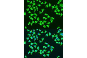 Immunofluorescence analysis of U2OS cells using ATP6 antibody. (MT-ATP6 Antikörper  (C-Term))