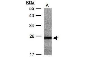 Western Blotting (WB) image for anti-RAB2B, Member RAS Oncogene Family (RAB2B) antibody (ABIN2856622)