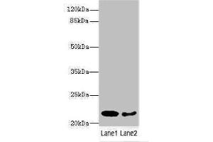Western blot All lanes: PRDX2 antibody at 9 μg/mL Lane 1: Mouse liver tissue Lane 2: Mouse spleen tissue Secondary Goat polyclonal to rabbit IgG at 1/10000 dilution Predicted band size: 22, 16 kDa Observed band size: 22 kDa (Peroxiredoxin 2 Antikörper  (AA 2-65))