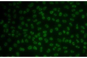 Immunofluorescence analysis of MCF7 cells using KHDRBS3 Polyclonal Antibody (KHDRBS3 Antikörper)