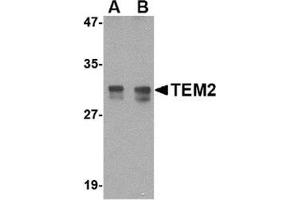 Western blot analysis of TEM2 in rat colon tissue lysate with this product at (A) 1 and (B) 2 μg/ml. (RASD2 Antikörper  (N-Term))