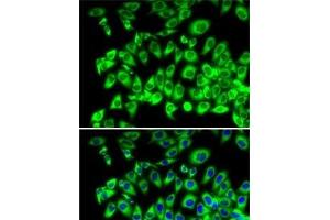 Immunofluorescence analysis of MCF7 cells using RPL13 Polyclonal Antibody