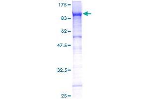 Endoglin Protein (ENG) (AA 1-658) (GST tag)