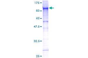 Image no. 1 for Endoglin (ENG) (AA 1-658) protein (GST tag) (ABIN1352793)