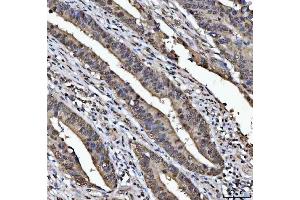 IHC analysis of TIP49A/RUVBL1 using anti-TIP49A/RUVBL1 antibody (ABIN7599928). (RUVBL1 Antikörper  (AA 13-23))