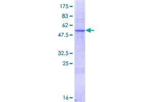 Image no. 1 for Folate Receptor 2 (Fetal) (FOLR2) (AA 1-255) protein (GST tag) (ABIN1354300)