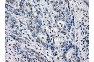 Image no. 1 for anti-Budding Uninhibited By Benzimidazoles 1 Homolog beta (Yeast) (BUB1B) antibody (ABIN1496996) (BUB1B Antikörper)